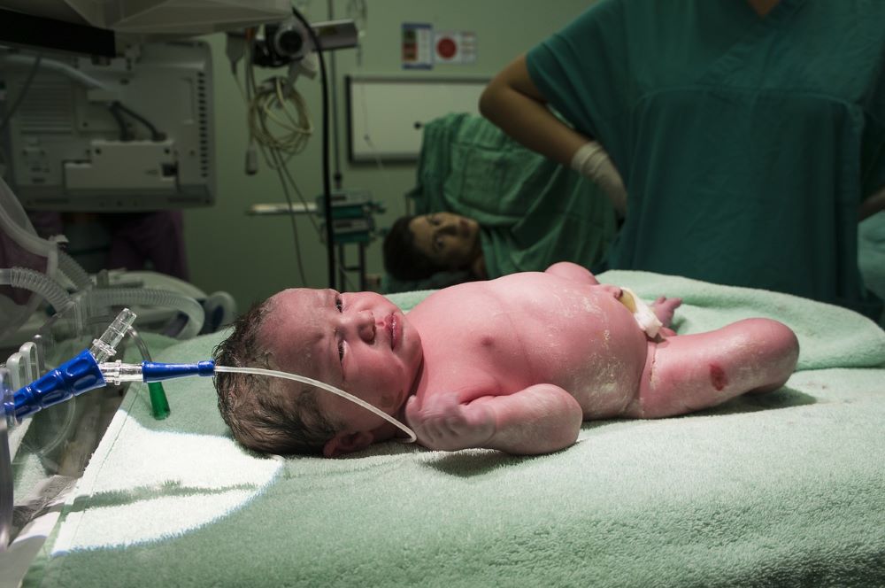 Premature Birth