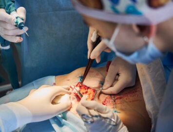 Surgical Errors and Anesthesia Errors