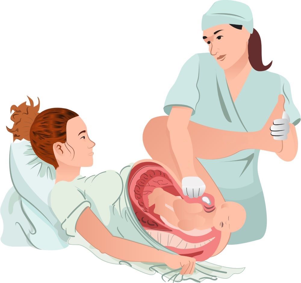 Visual guide explaining shoulder dystocia in childbirth