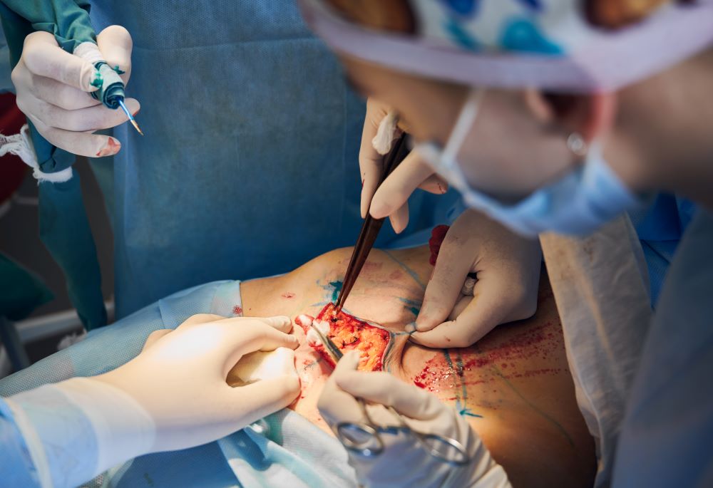 Preventing Wrong Site Surgery